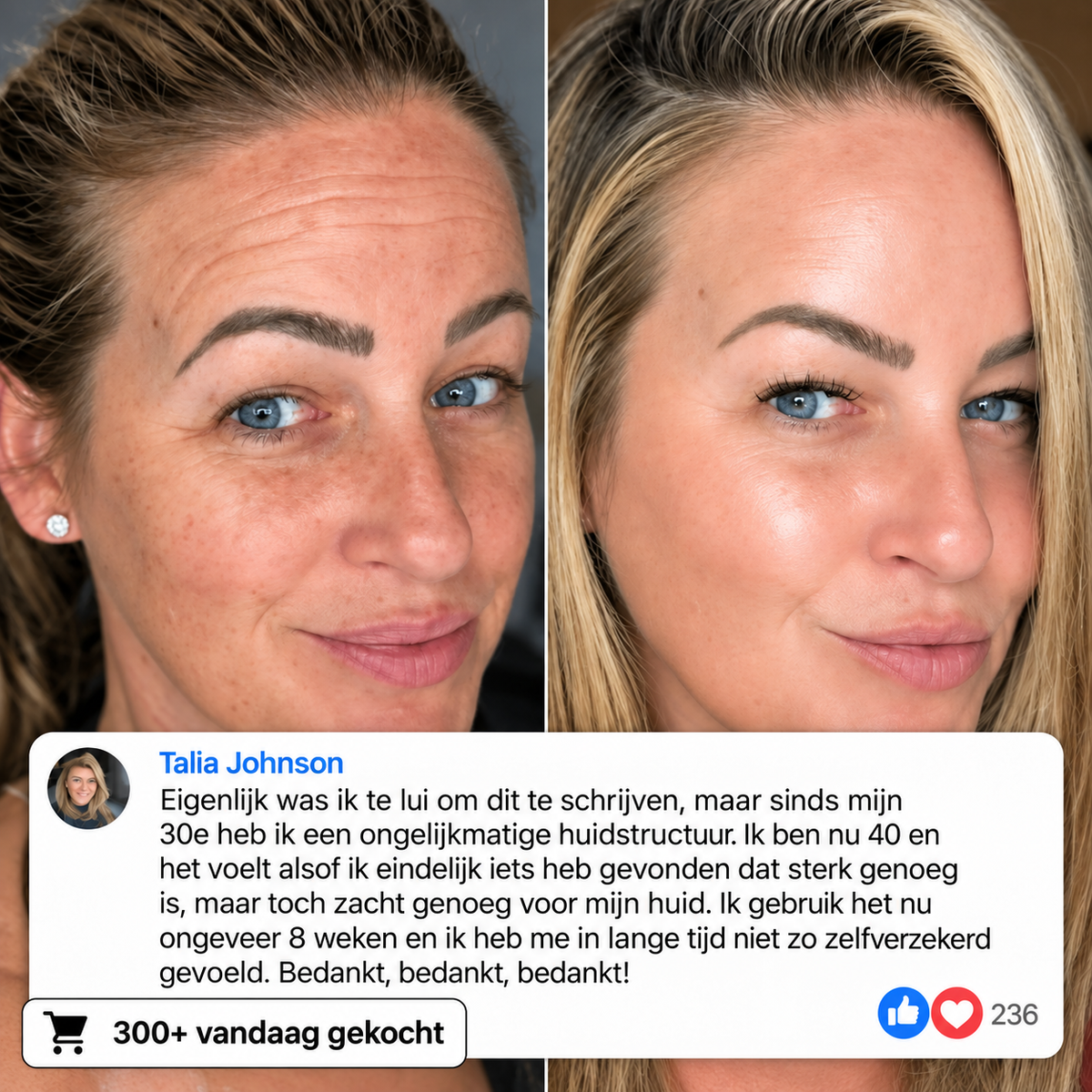 Koreaanse Collageen Volume Multi-balsem