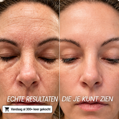 Koreaanse Collageen Volume Multi-balsem