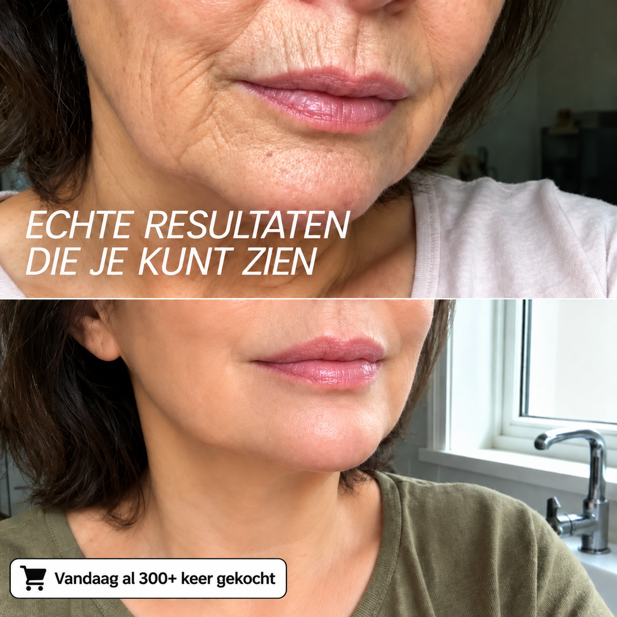 Koreaanse Collageen Volume Multi-balsem