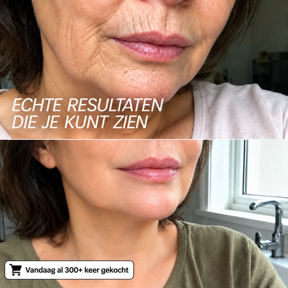 Koreaanse Collageen Volume Multi-balsem